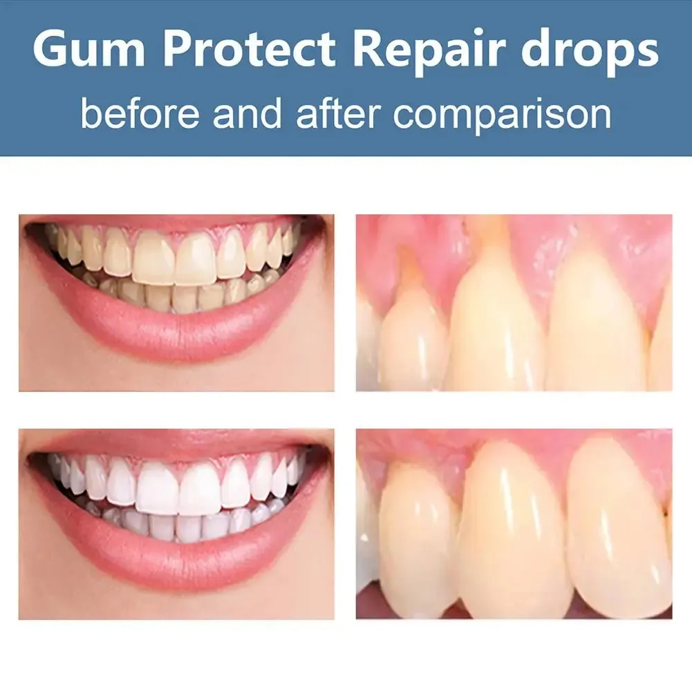Quickly Gum Repair Serum